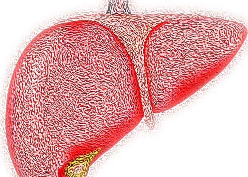Cirrosis hepática
