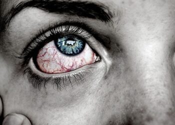 Conjuntivitis: entre los síntomas de Ómicron