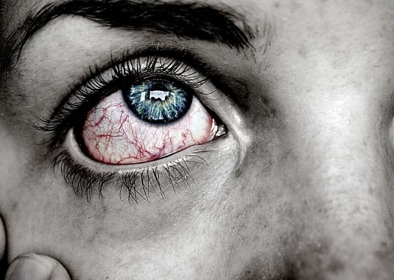 Conjuntivitis: entre los síntomas de Ómicron