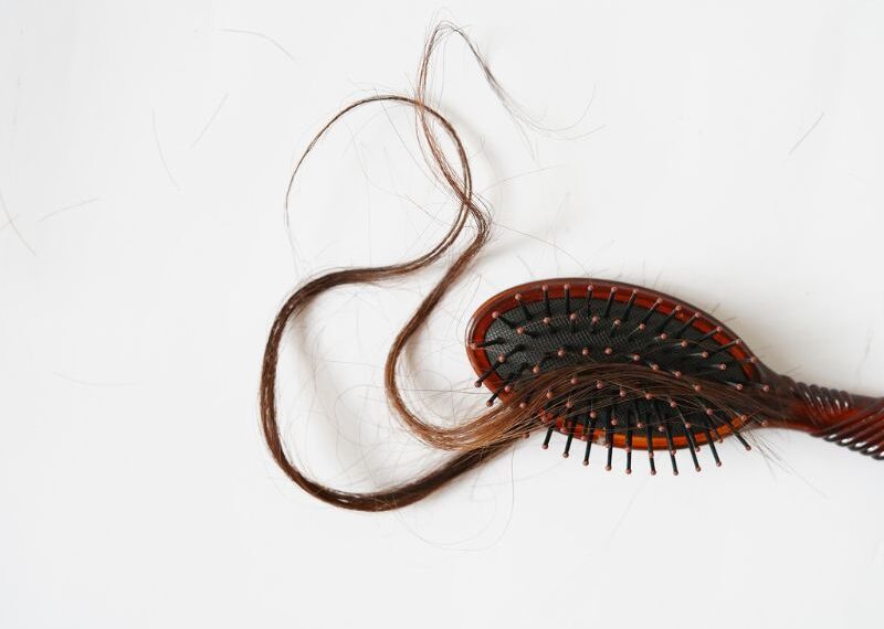 Alopecia