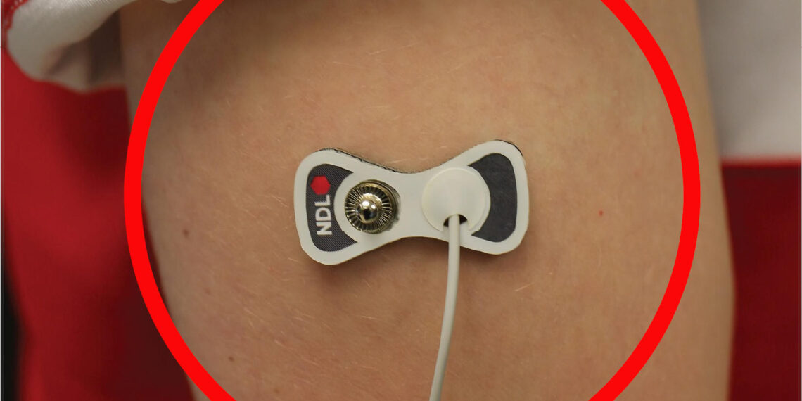 Interstitial Fluid Device