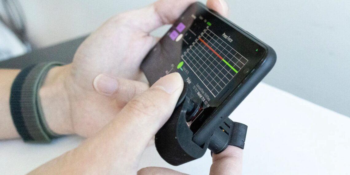 Monitoreo de la presión arterial en la yema del dedo: accesorio de teléfono inteligente de bajo costo