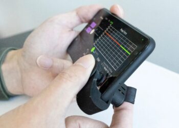 Monitoreo de la presión arterial en la yema del dedo: accesorio de teléfono inteligente de bajo costo