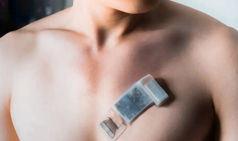 A Wearable Ultrasonic System on Patch