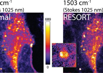 Nueva técnica de imágenes de microscopía: RESORT revela sistemas vivos como nunca antes